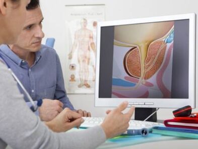 A urologist consults a patient about potency problems
